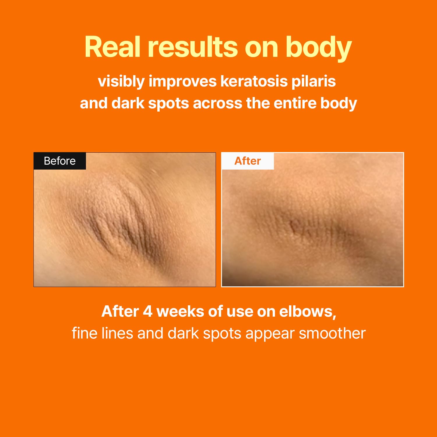 Orvixa LuminaRetinal Skin Booster Serum
