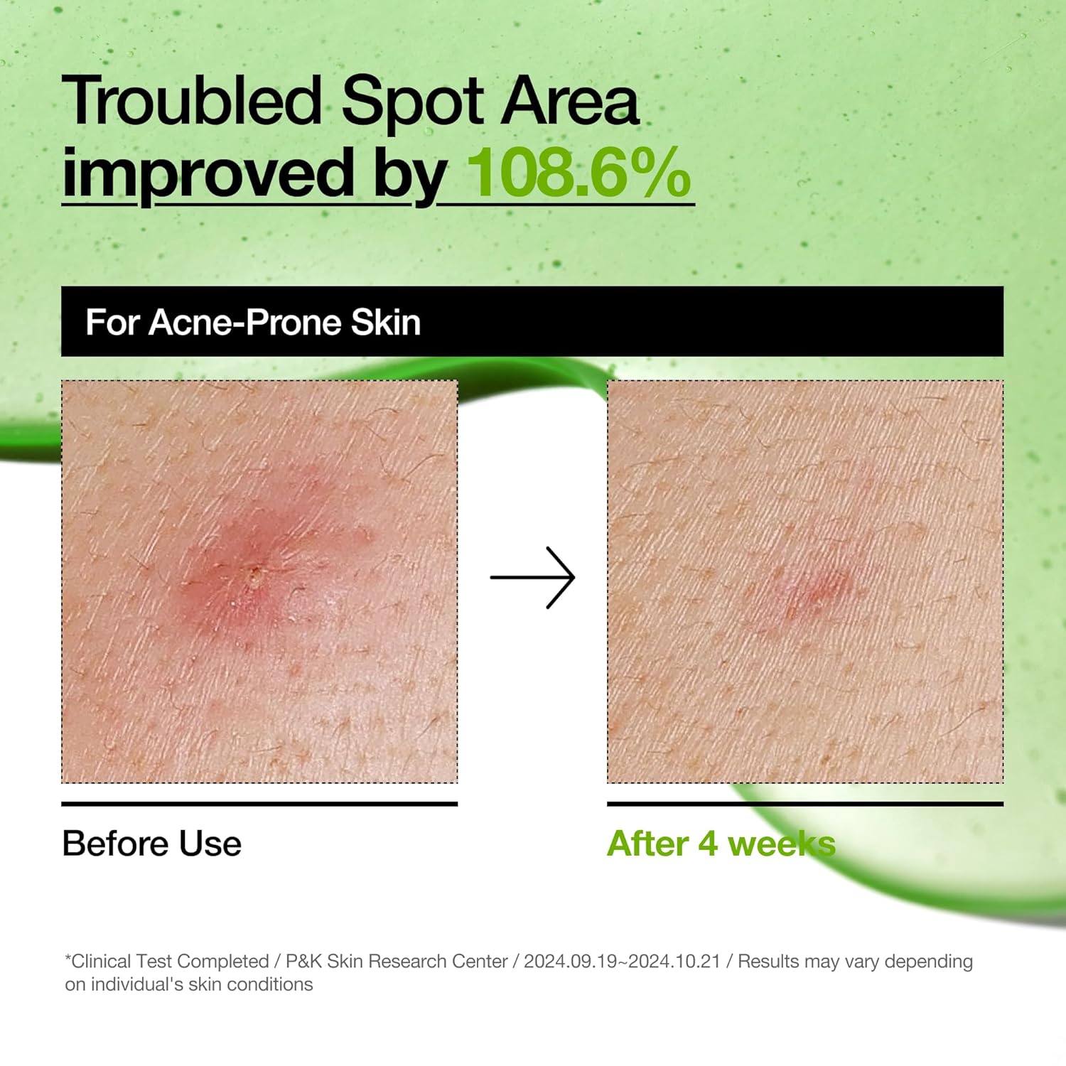Orvixa Serene Azelaic Hyaluron Serum