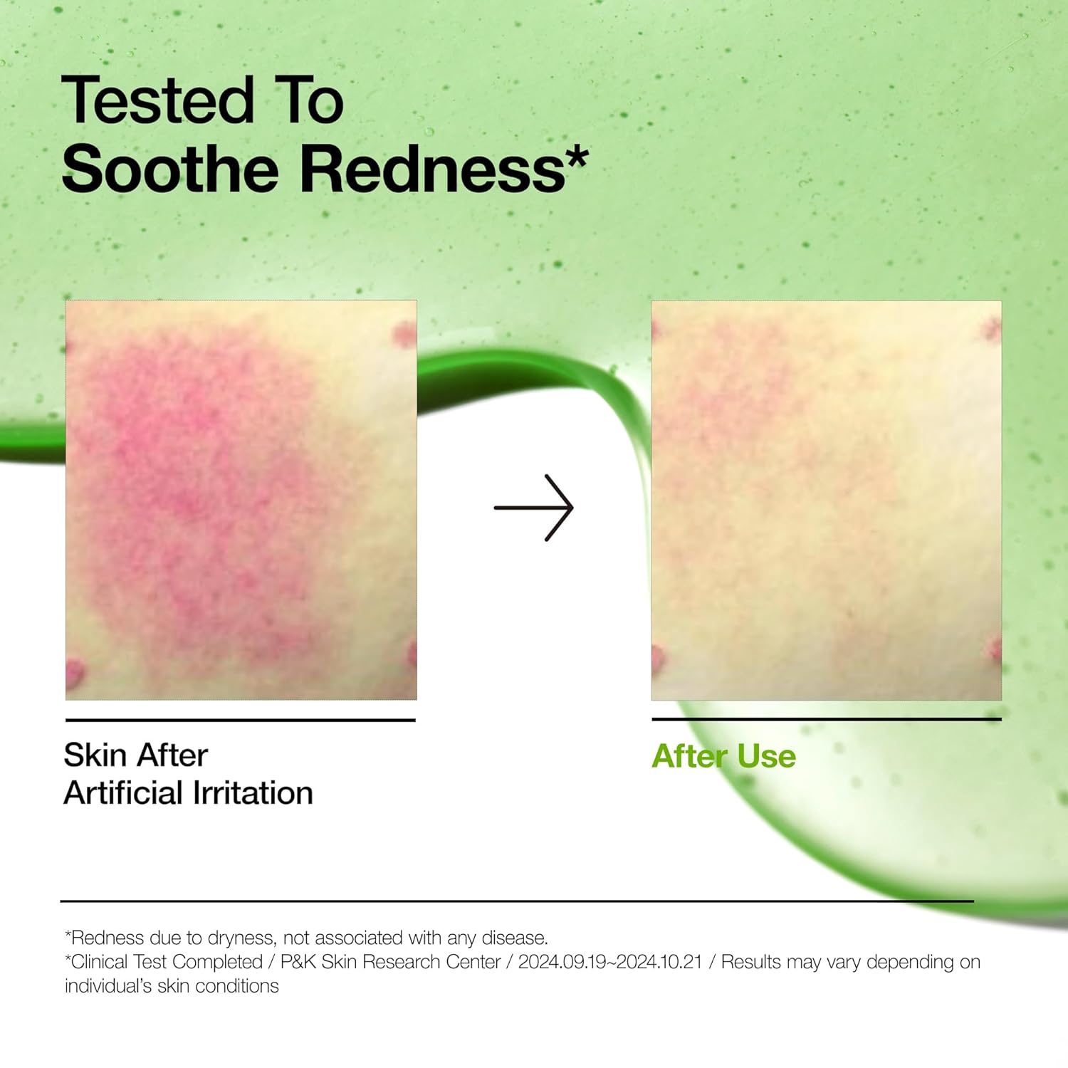 Orvixa Serene Azelaic Hyaluron Serum
