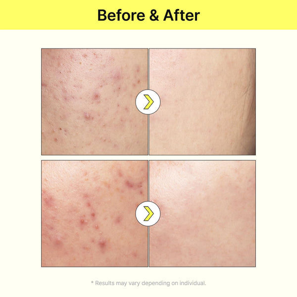 Vita B Niacinamide Serum